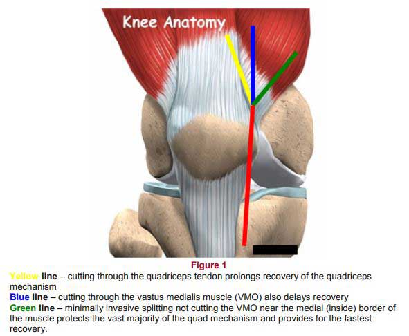 knee model