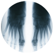 foot and ankle surgery