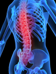 Epidural Injections & Back Pain Louisville KY 